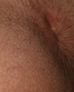 My anus collection 1